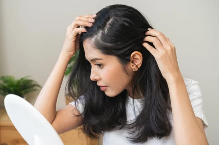 10 Effective Homeopathic Medicines for Hair Fall: A Comprehensive Guide