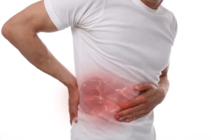 Kidney Stones: A Painful Reminder from Within